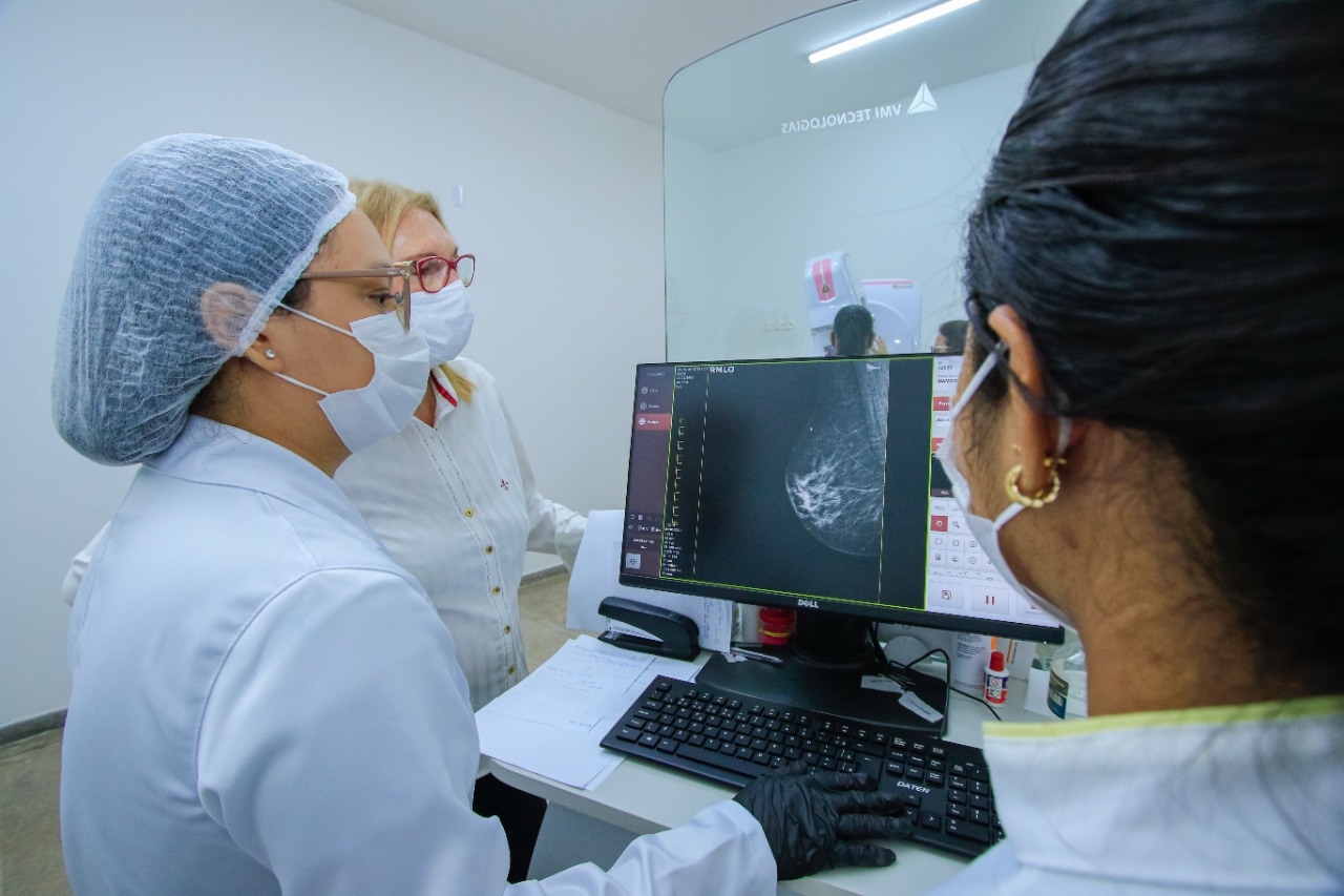 Uncisal disponibiliza 5 mil exames de mamografia até o fim do ano